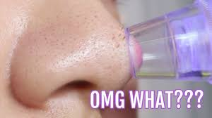 Black Heads Remover Vaccum